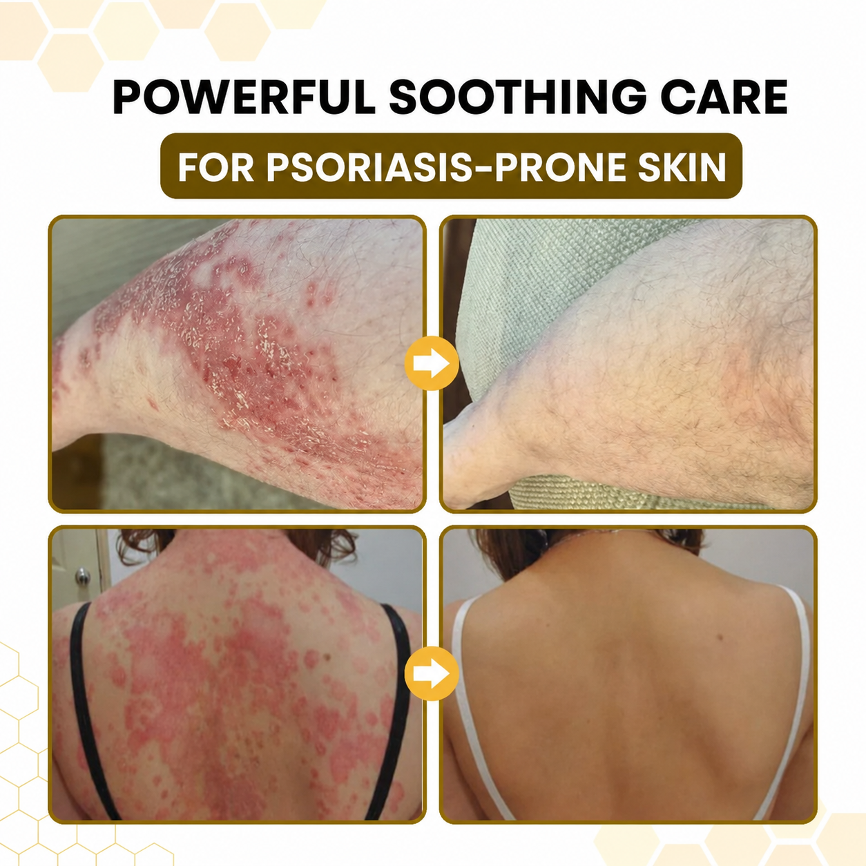🐝 Velioraen® Ease Skin