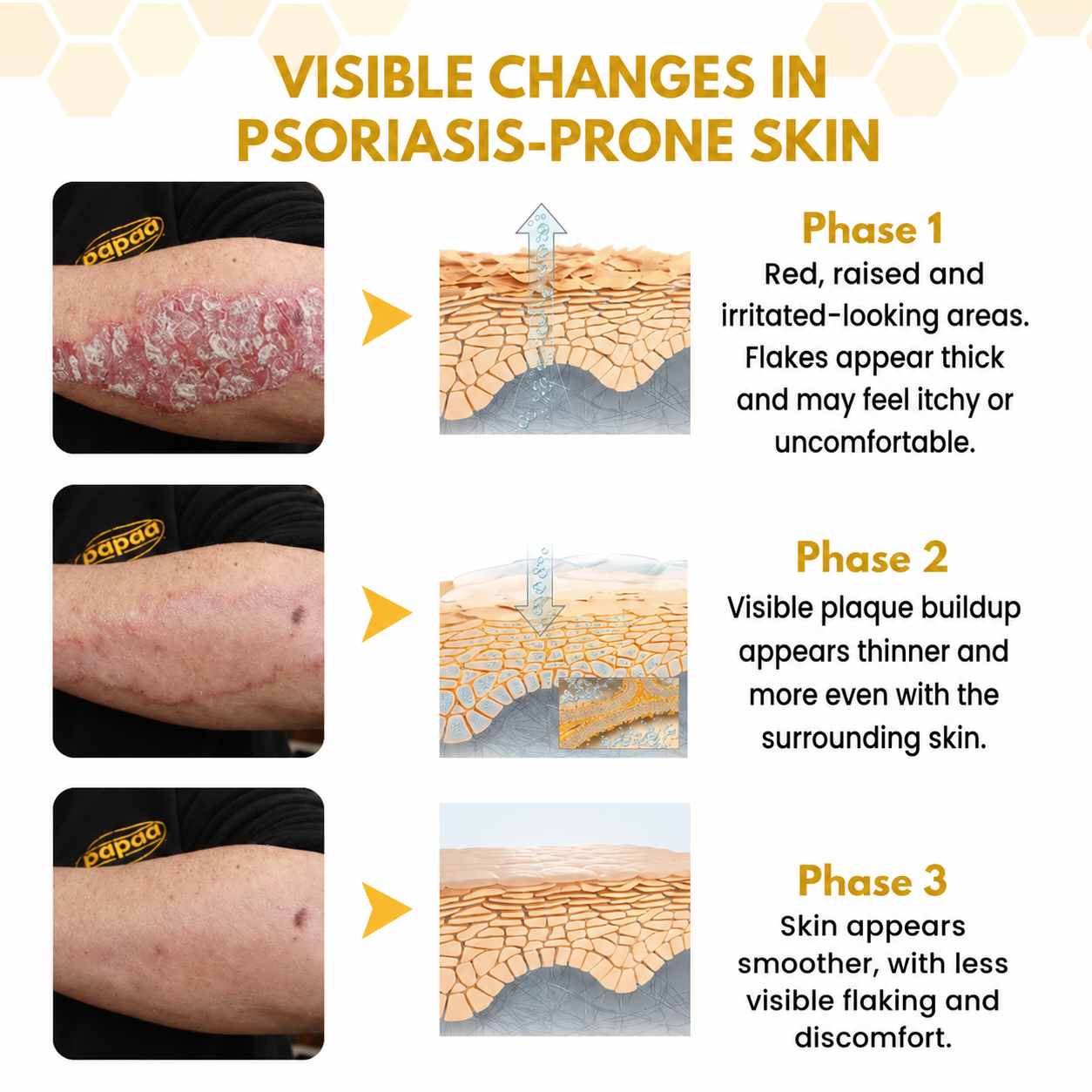 🐝 Velioraen® Ease Skin
