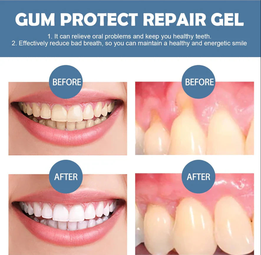 Velioraen™ Teeth Repair Gel