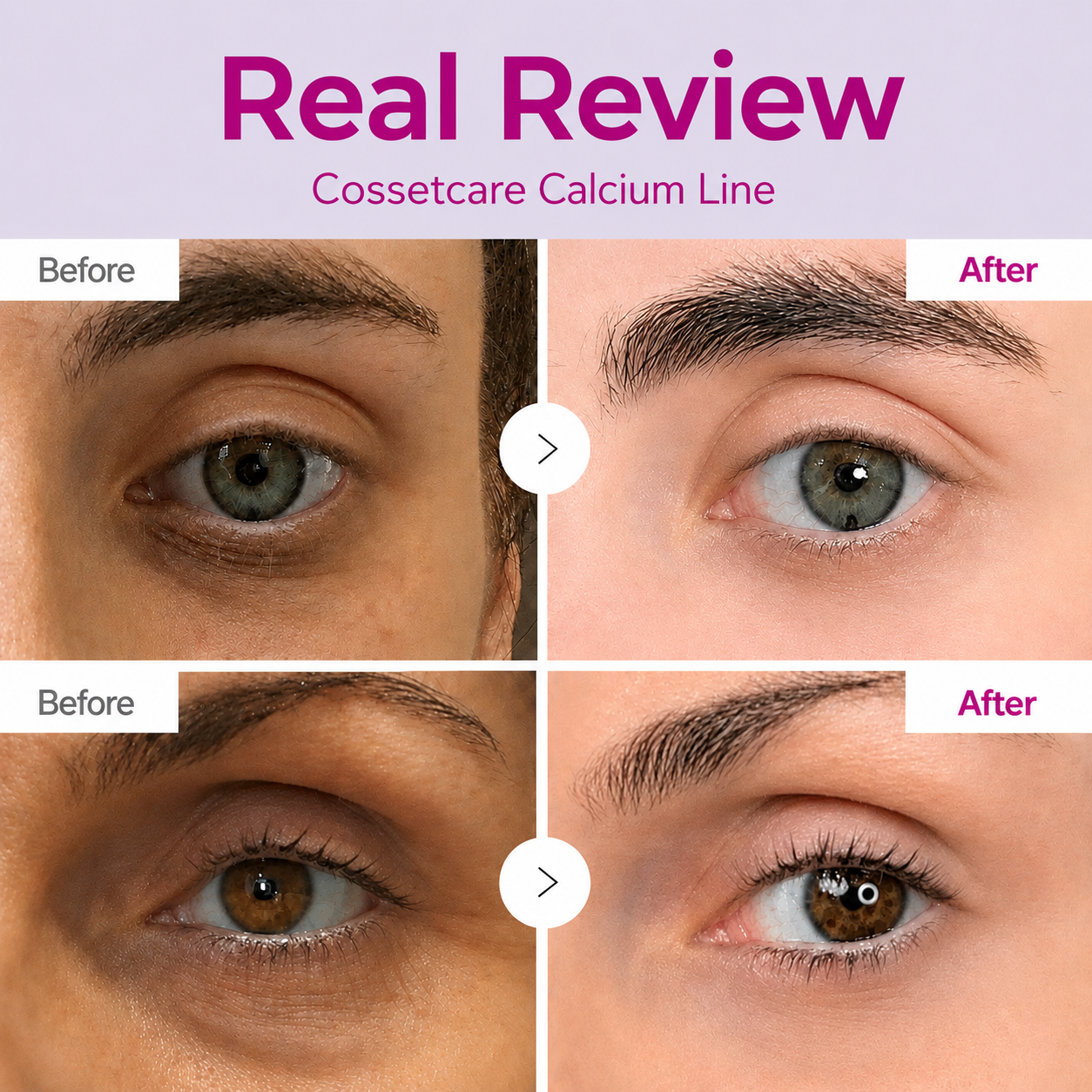 🔥LAST DAY 50% OFF!!Velioraen Korean Calcium Dark Spot Eye Cream