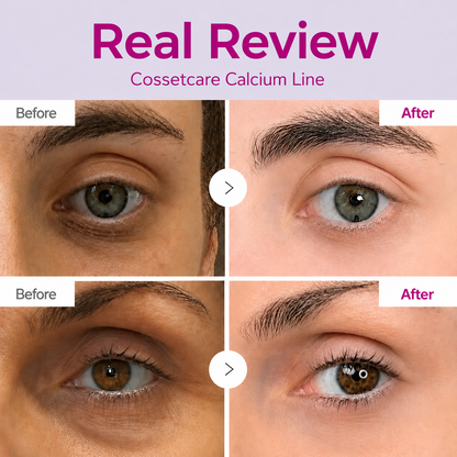 🔥LAST DAY 50% OFF!!Velioraen Korean Calcium Dark Spot Eye Cream