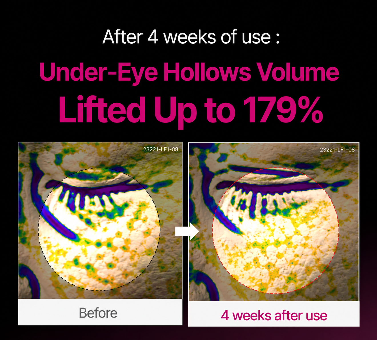 🔥LAST DAY 50% OFF!!Velioraen Korean Calcium Dark Spot Eye Cream